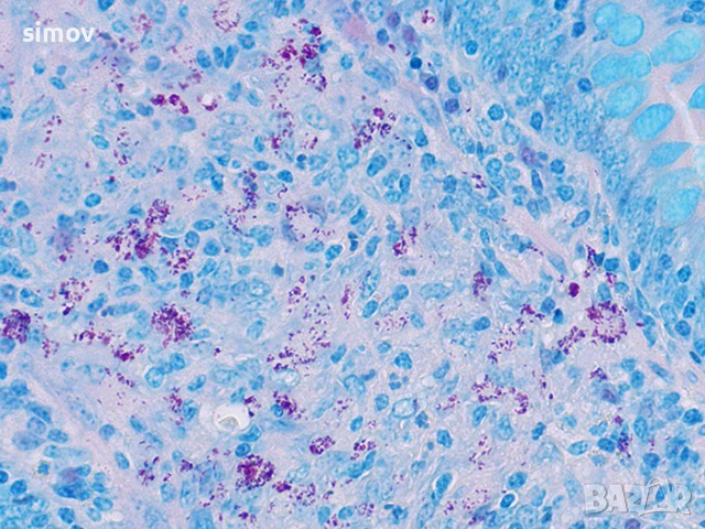 Основен фуксин 99 % прах - багрило за микроскопско наблюдение., снимка 3 - Лаборатория - 53691705