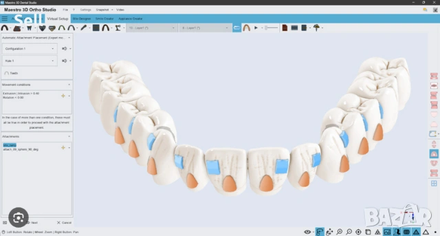 Професионална инсталация на дентални софтуери Exocad, 3shape и други, снимка 3 - Преинсталации - 53177771