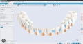 Професионална инсталация на дентални софтуери Exocad, 3shape и други, снимка 3