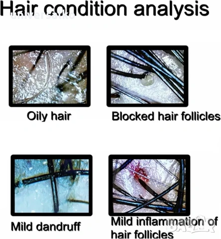 Скенер за диагностика на скалп и кожа, детектор за фоликулит, снимка 6 - Фризьорски принадлежности - 46097115