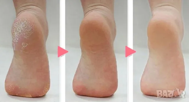 Електрическият уред за пилинг на пети и кожички, снимка 3 - Други стоки за дома - 49248645