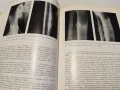 Медицина -Рентгенова Диференциална диагноза-том 1, снимка 4