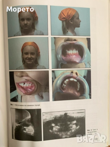 Ръководство по ортодонтия за студенти-проф.Вера Крумова, снимка 7 - Специализирана литература - 52864027