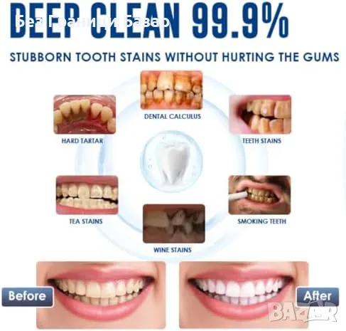 Нов Комплект за почистване на зъби с камера | Премахва плака и зъбен камък, снимка 3 - Други - 47782984