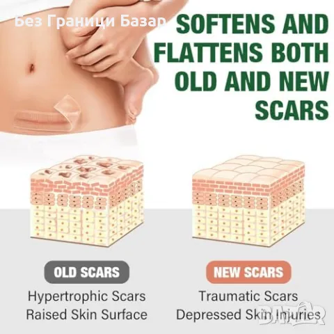 Нови Лепенки против белези – силикон, многократна употреба, безопасни, снимка 5 - Други - 49815364