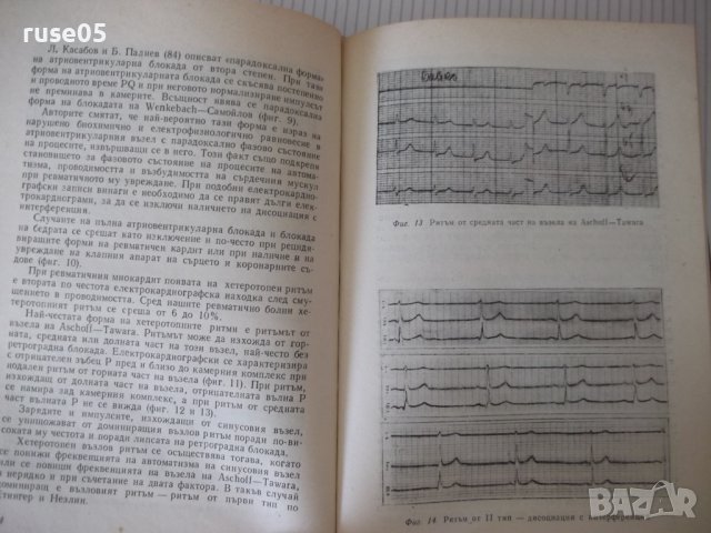 Книга "Ревматичен миокардит - Димитър Шишманов" - 180 стр., снимка 6 - Специализирана литература - 40451432