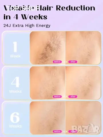 Устройство за лазерна епилация Wavytalk, с кабел (розово), снимка 4 - Епилатори - 49866446