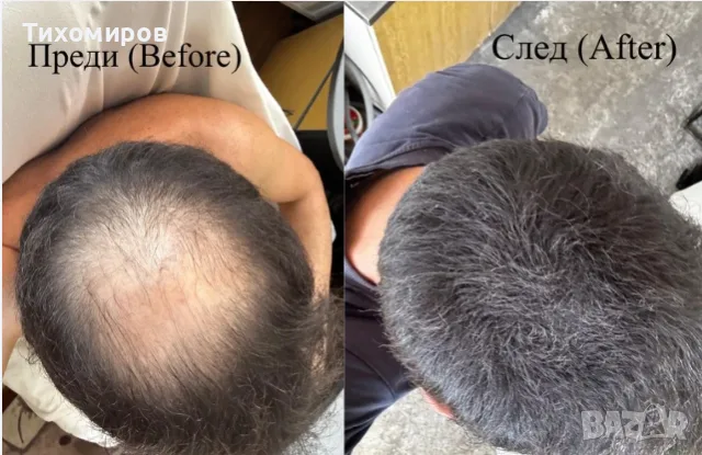 Фибри за коса (Всички цветове) - Изпитан продукт от мен - 27.5g. Hair Building Fibers (All Colors)