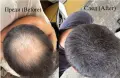 Фибри за коса (Всички цветове) - Изпитан продукт от мен - 27.5g. Hair Building Fibers (All Colors), снимка 1