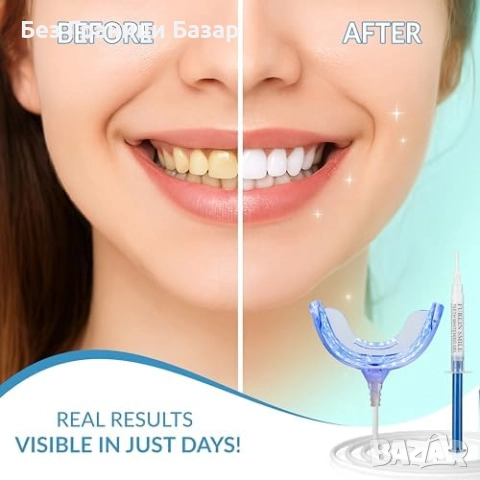 Нов Домашен комплект за избелване на зъби с 8 гела и 32 LED светлини, снимка 4 - Декоративна козметика - 52772607