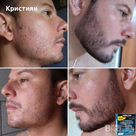Kirkland Minoxidil - Разтвор против косопад Лечение 6 месеца 6 X 60гр, снимка 3 - Други - 50464499