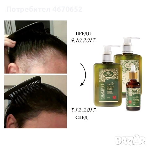 Комплект за растеж на косата „Bio Rehab“, снимка 2 - Продукти за коса - 52755138