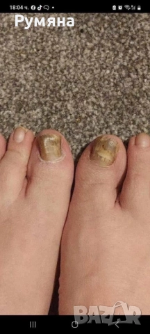 Мехлем срещу гъбички по ноктите и кожата , снимка 2 - Други - 51082505