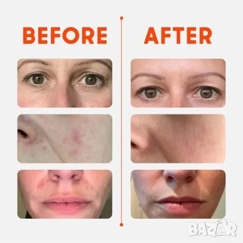 Нов Дълбоко хидратиращ балсам за суха кожа, лице и тяло 30г грижа жени, снимка 4 - Козметика за лице - 47957195