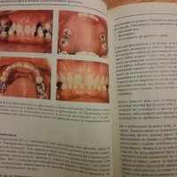 Имплантологията в общата стоматологична практика- Сиърсън, Гауф, Хемингс - 2005г., 102 стр., снимка 8 - Специализирана литература - 42554758