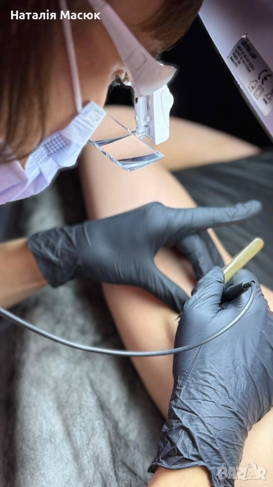 Електроепилация в Пловдив – Премахване на косми завинаги., снимка 1