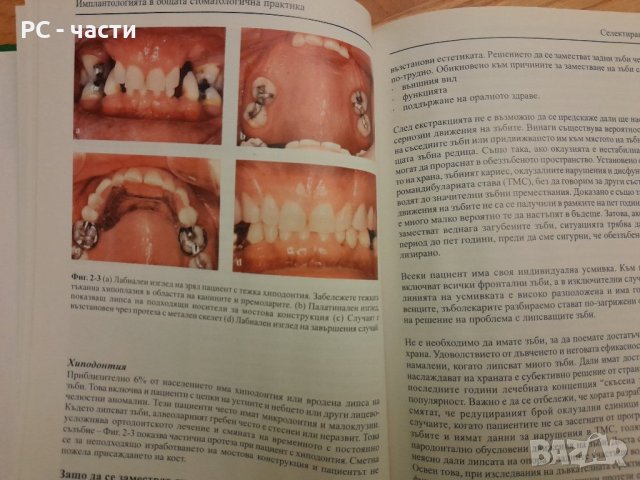 Имплантологията в общата стоматологична практика- Сиърсън, Гауф, Хемингс - 2005г., 102 стр., снимка 8 - Специализирана литература - 42554758