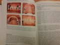 Имплантологията в общата стоматологична практика- Сиърсън, Гауф, Хемингс - 2005г., 102 стр., снимка 8