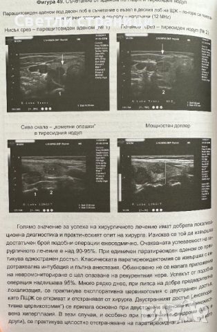 паращитовидни жлези, витамин D и калциево-фосфорна обмяна, снимка 6 - Специализирана литература - 41530979