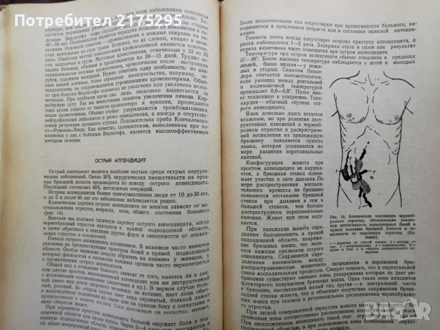 Симптоматична диагностика на хирургичните заболявания-1973г.руско издание, снимка 3 - Специализирана литература - 44592478