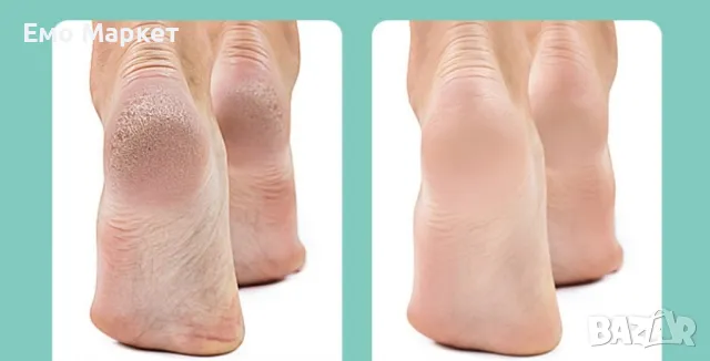 Електрическият уред за премахване на мъртва кожа от петите, снимка 4 - Други стоки за дома - 49020660