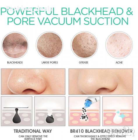 Нов Вакуум уред за отстраняване на черни точки Почиства пори за лице, снимка 6 - Други - 34735660