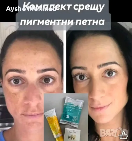 Помощ при пигментни петна TianDe