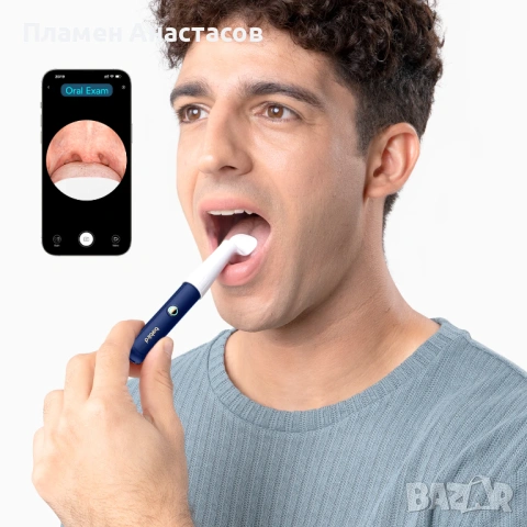 Bebird EarSight Plus – смарт комплект за почистване и преглед на уши с камера, бял, снимка 9 - Други - 53622532