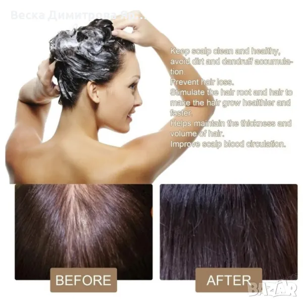 Оризов сапун против косопад, снимка 1