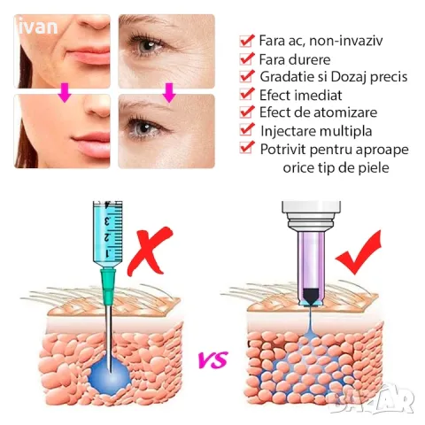 Хиалурон пен, Безиглен инжектор за мезотерапия и филъри Hyaluronic pen, снимка 5 - Козметични уреди - 50079767