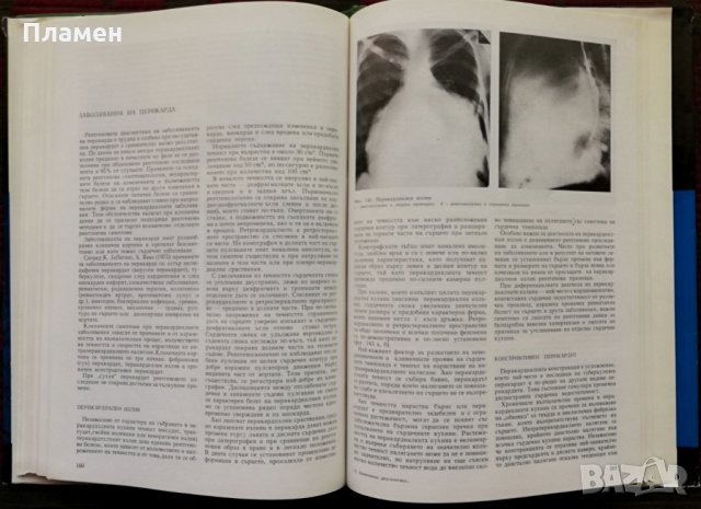 Рентгенова и радиоизотопна диагностика на заболяванията на сърцето и големите съдове, снимка 3 - Специализирана литература - 35848291