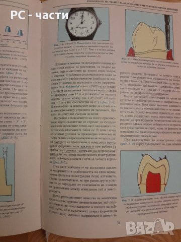 Изпиляване на зъбите за керамични и металокерамични коронки - Христо Кисов,  2000г., 186стр., снимка 7 - Специализирана литература - 42555084