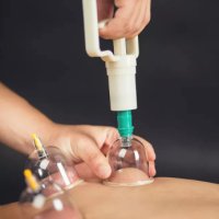 Професионални вендузи/вакуум чашки за здравословен масаж , снимка 6 - Други - 39575023