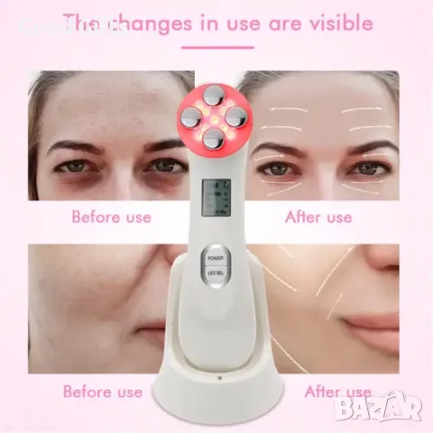 Уред за безиглена мезотерапия CkeyiN 5+1, Електромускулна стимулация, Електропорация, Мезопорация, Р, снимка 7 - Други - 47510183