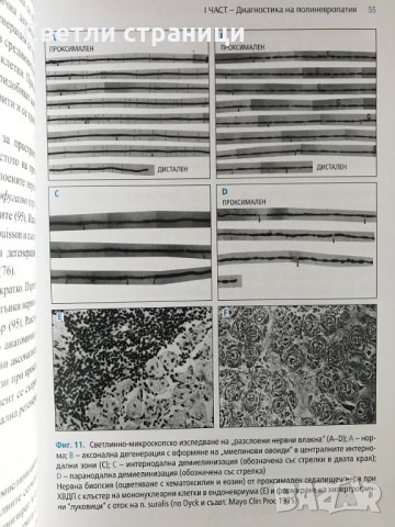 Имуномедиирани възпалителни невропатии - Пламен Цветанов, снимка 6 - Специализирана литература - 35771643