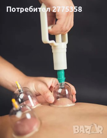 32 броя сет професионални вендузи за здравословен масаж, в кутия! , снимка 5 - Други - 39575023