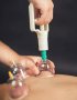 Професионални вендузи/вакуум чашки за здравословен масаж , снимка 6