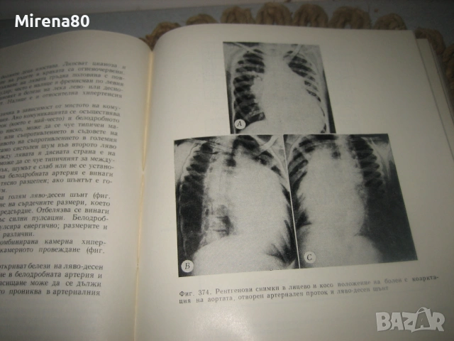 Детска кардиология - А. Надас, снимка 9 - Специализирана литература - 53528879