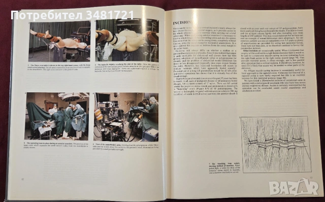 Голям атлас на колоректалната хирургия / A Colour Atlas of Colorectal Surgery, снимка 5 - Специализирана литература - 53748180