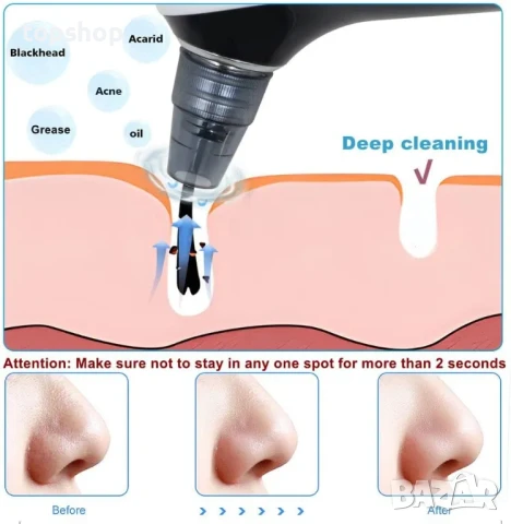 НОВ Професионален апарат за премахване на черни точки 5 в 1, функция за нагряване 45° USB type C, снимка 6 - Маши за коса - 50494967