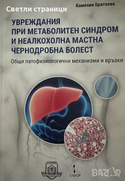 Увреждания при метаболитен синдром и неалкохолна мастна чернодробна болест, снимка 1