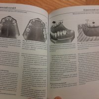 Конструкция на частичната снемаема зъбна протеза- Хоман, Хилшер- 2002г., 194стр., снимка 12 - Специализирана литература - 42555345