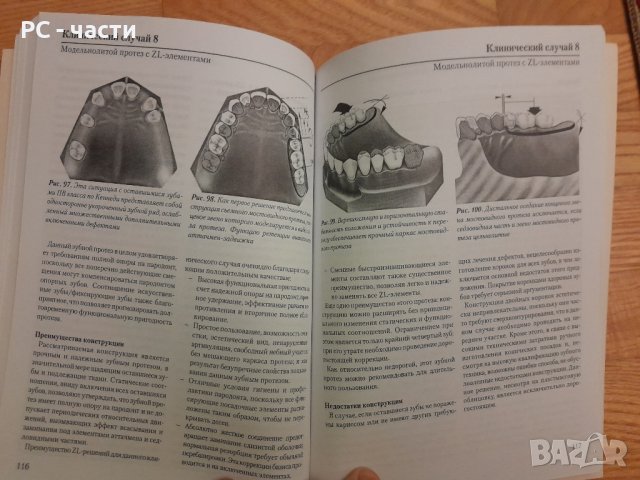 Конструкция на частичната снемаема зъбна протеза- Хоман, Хилшер- 2002г., 194стр., снимка 12 - Специализирана литература - 42555345