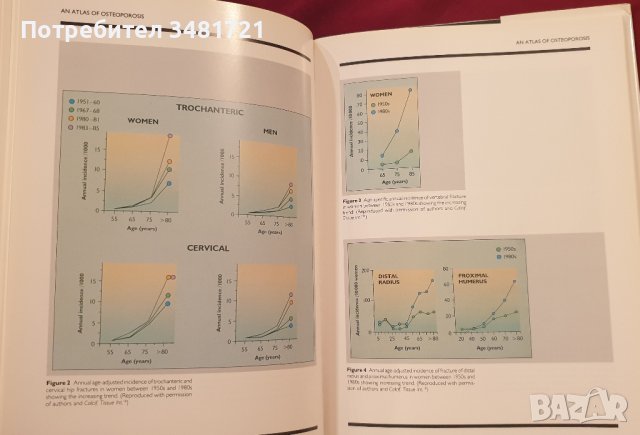 Атлас на остеопорозата / Atlas of Osteoporosis, снимка 5 - Енциклопедии, справочници - 41376795