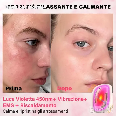 Електрически радиочестотен лифтинг масаж за лице , снимка 5 - Друга електроника - 50277898