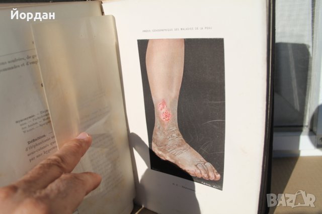 Френска медицинска книга за кожни заболявания, снимка 8 - Специализирана литература - 42654446