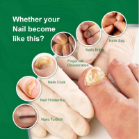 Спрей за лечение на гъбички по ноктите 10мл(гладки нокти), снимка 7 - Други - 44553439