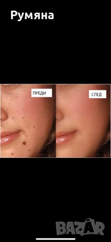 Тинктура срещу папиломи брадавици и кокоши трън , снимка 4 - Други - 52431713