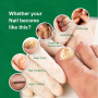 Спрей за лечение на гъбички по ноктите 10мл(гладки нокти), снимка 7