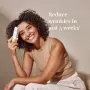 Silk’n FaceTite Revive - Уред за изглаждане на бръчките и стягане на кожата, снимка 1